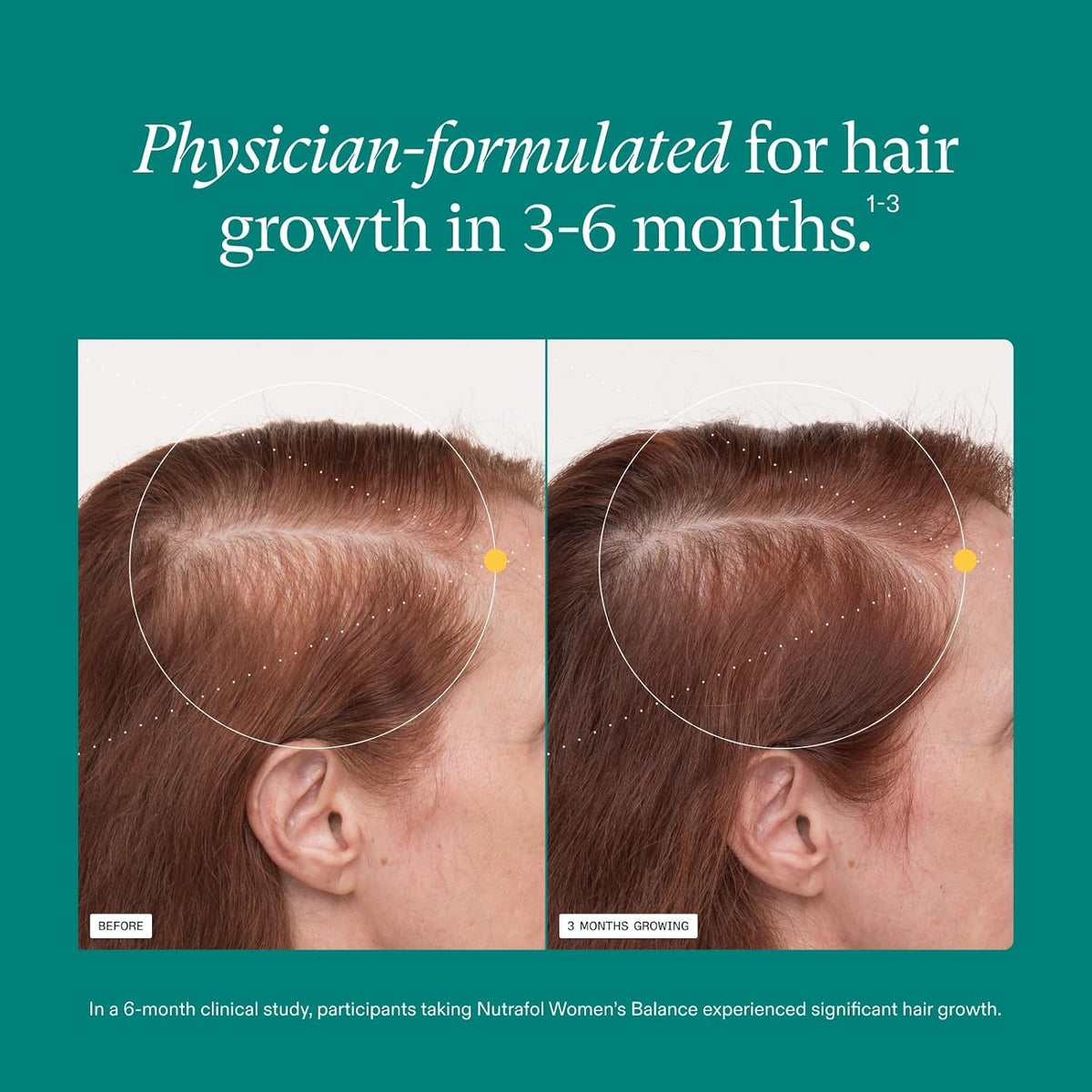 Nutrafol Women’s Balance Hair Growth Nutraceutical|Hair Growth Support Designed for Women 45+